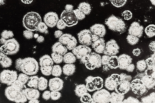 3 Tips For Detecting Black Mold In Crawles Rytech 3 Tips For Detecting Black Mold In Crawles